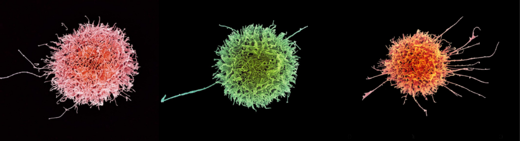 Research blog: Harnessing the power of the body’s natural killer cells ...